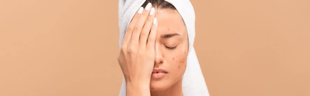 unhappy woman covering half of her face with a hand