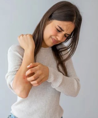 a young woman suffering from skin issues